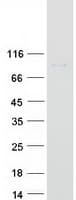 Human HGF / Hepatocyte Growth Factor Protein (Recombinant Myc-DDK (Flag))