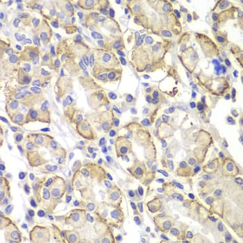 LYN Antibody