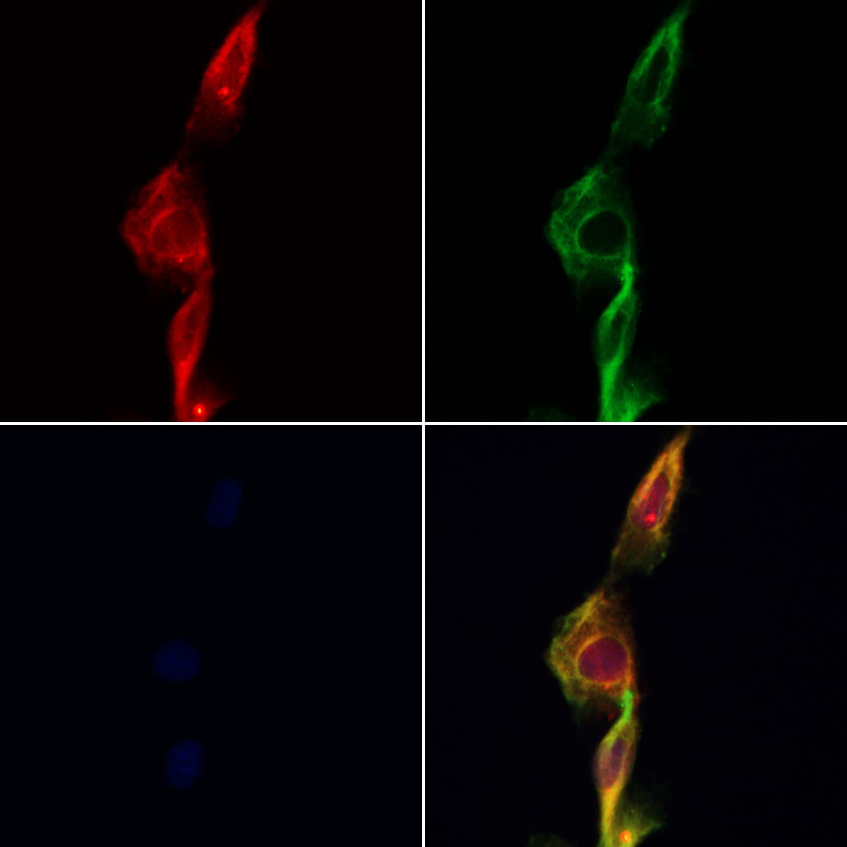 Polyclonal Rabbit anti-Human EIF2S3 / EIF2G Antibody (IF, WB)