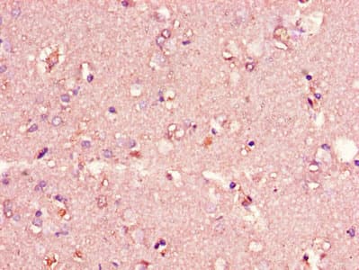 CIDEA / CIDE-A Antibody