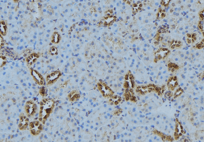 LPCAT1 / AYTL2 Antibody