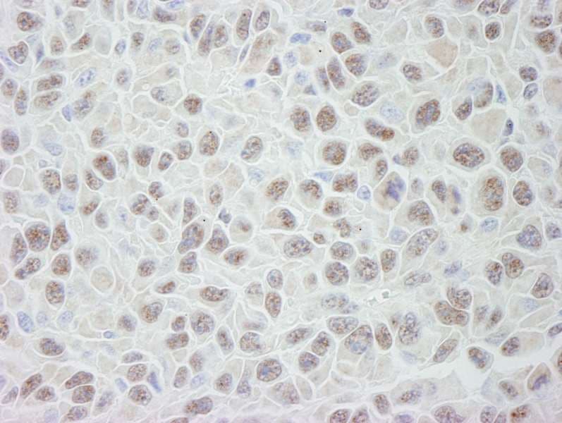 PRPF19 / PRP19 Antibody (aa25-75)