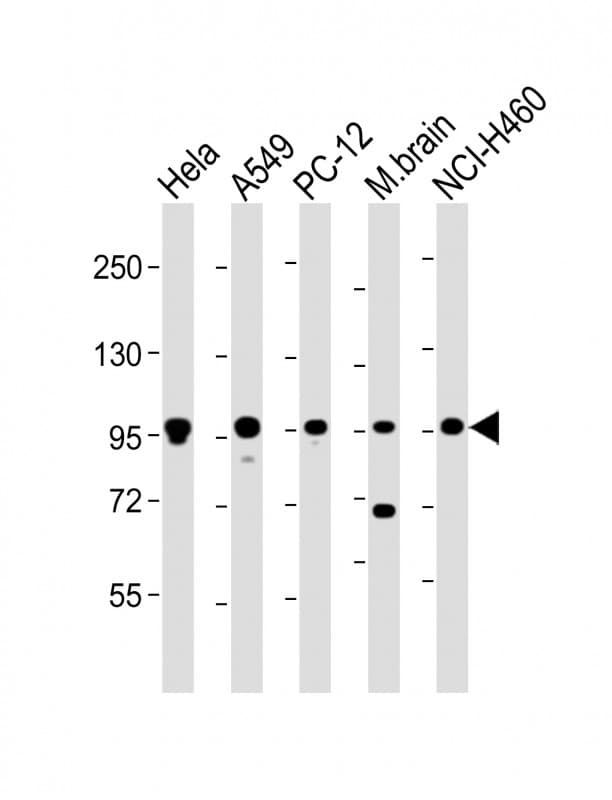 PCSK1 Antibody (C-Terminus)
