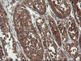 TPD52L3 Antibody (clone OTI4C12, Carrier-free)