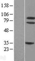 NTRK1 / TrkA Protein (Over-Expression Lysate Myc-DDK (Flag))