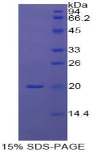 Bovine CASP8 / Caspase 8 Protein (Recombinant His)