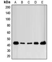 FGFR1OP / FOP Antibody (C-Terminus)