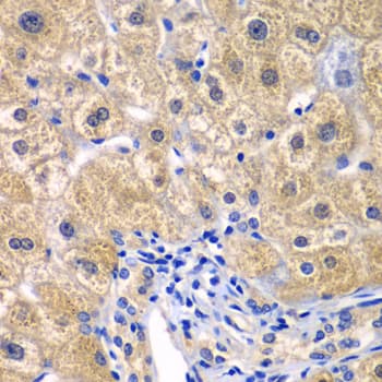 CARMA1 / CARD11 Antibody