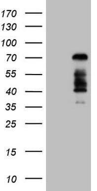 FOXO4 / AFX1 Antibody (aa206-505, clone OTI2C5, Carrier-free)