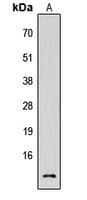 Polyclonal Rabbit anti-Human CST3 / Cystatin C Antibody (Internal, WB)