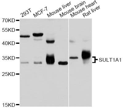 SULT1A1 / Sulfotransferase 1A1 Antibody