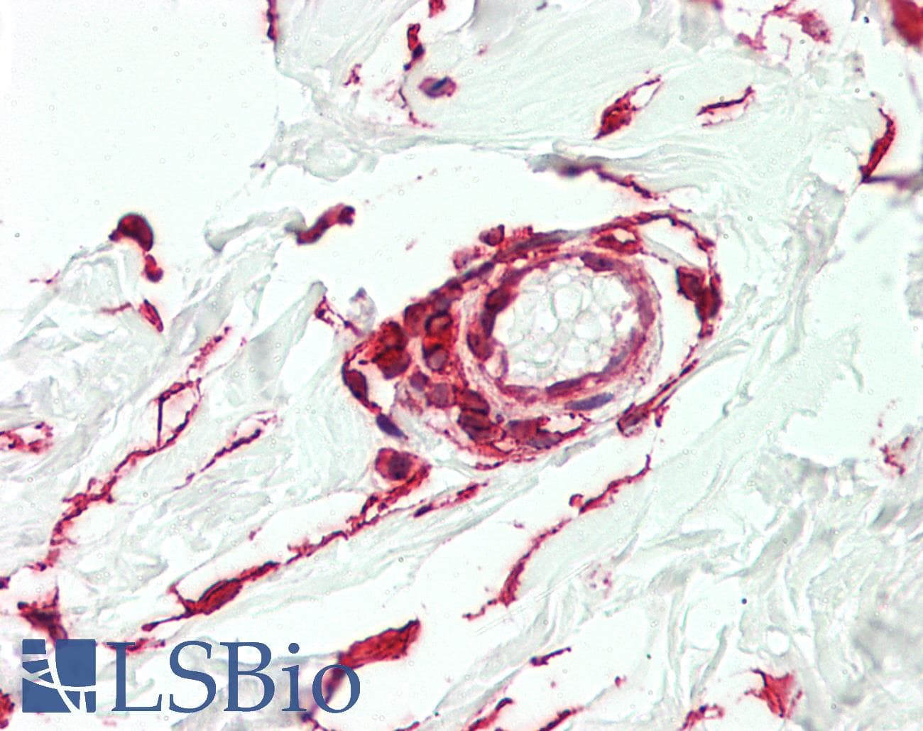 IHC-plus™ CTHRC1 Antibody (clone 1G12)