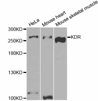 KDR / VEGFR2 / FLK1 Antibody