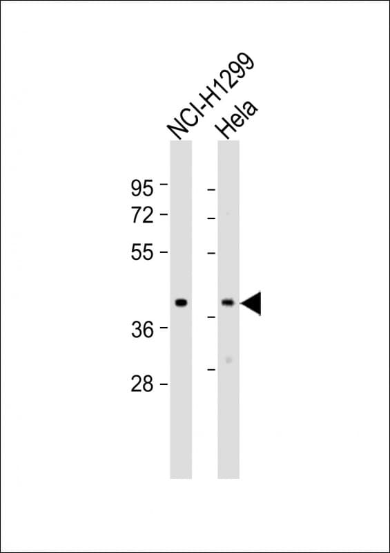 Polyclonal Rabbit anti-Human TWF1 / PTK9 Antibody (aa137-171, WB)