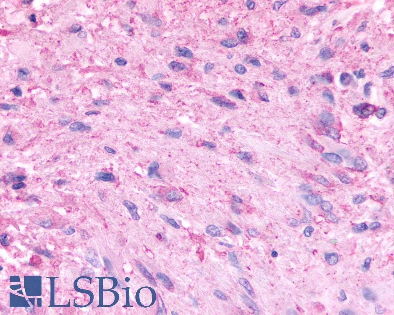 PathPlus™ HTR5A / 5-HT5A Receptor Antibody (Cytoplasmic Domain)