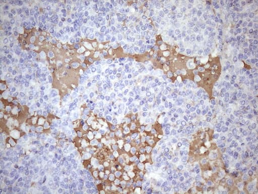 KIAA1524 / p90 Autoantigen Antibody (aa635-905, clone OTI1C11, Carrier-free)