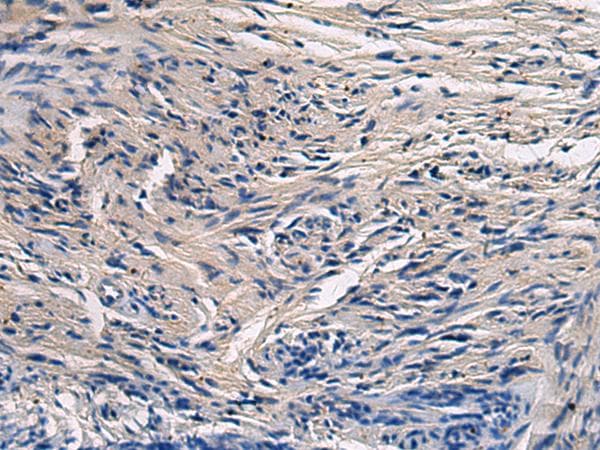 CYTIP Antibody