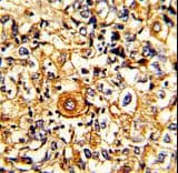 PTAR1 Antibody (aa60-89)