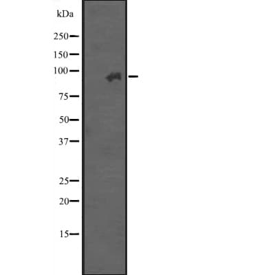 ITGB7 / Integrin Beta 7 Antibody