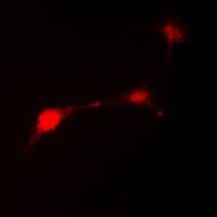 PARK2 / Parkin 2 Antibody (N-Terminus)