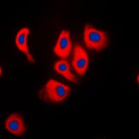 MAPK8IP2 / JIP2 Antibody (C-Terminus)