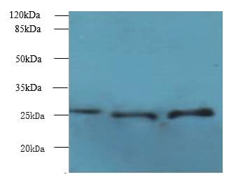 Polyclonal Rabbit anti-Human BARX1 Antibody (WB)