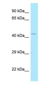 Polyclonal Rabbit anti-Human POLDIP2 / PDIP38 Antibody (C-Terminus, WB)