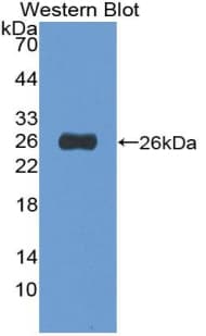 TACR2 / NK2R Antibody (aa1-200)