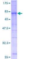 Human USP25 Protein (Recombinant GST)
