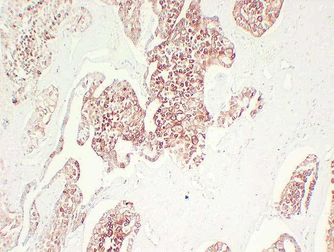 IHC-plus™ Monoclonal Mouse anti-Human KRT7 / CK7 / Cytokeratin 7 Antibody (clone ABT-CK7, IHC, WB)
