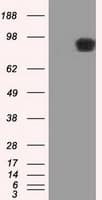 APP / Beta Amyloid Precursor Antibody (clone OTI2B10)
