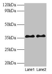 SPT3 / SUPT3H Antibody