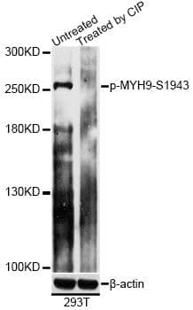 MYH9 Antibody (phospho-Ser1943)