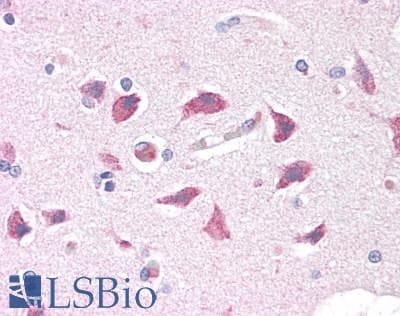 IHC-plus™ Polyclonal Rabbit anti-Human NDUFS7 Antibody (aa119-146, IHC, WB)