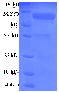 Mouse ADCK2 Protein (Recombinant His)