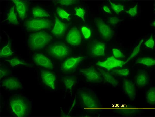 PathPlus™ KRT20 / CK20 / Cytokeratin 20 Antibody (clone 2G3-1C8)