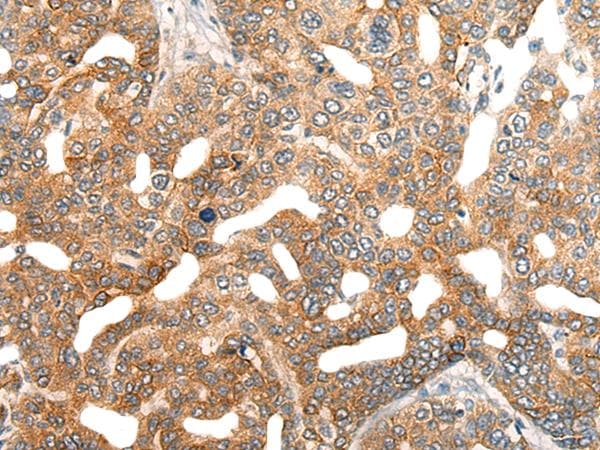 Polyclonal Rabbit anti-Human HIPK2 Antibody (IHC, WB)