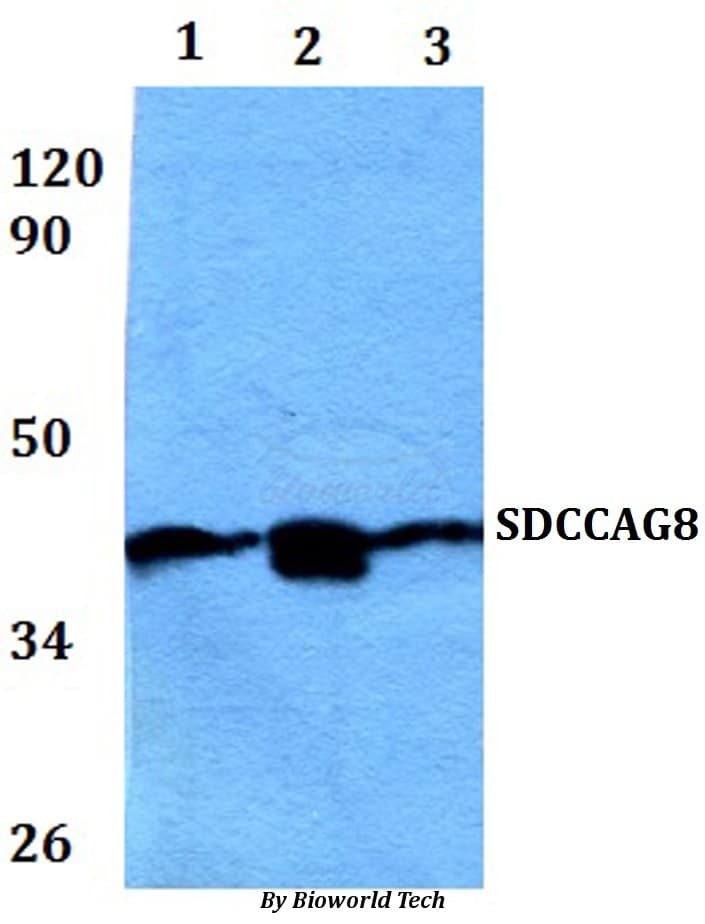 Polyclonal Rabbit anti-Human SDCCAG8 Antibody (WB)