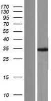 TPM4 Protein (Over-Expression Lysate Myc-DDK (Flag))