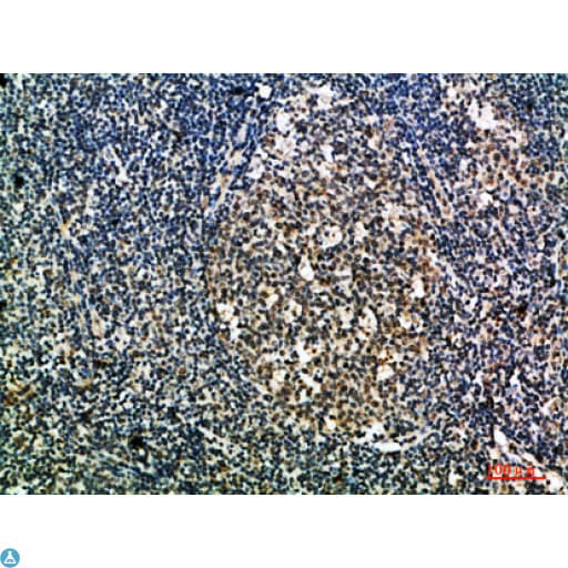 Polyclonal Rabbit anti-Human ITGAX / CD11c Antibody (IHC)