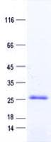 Human HSPC133 / METTL5 Protein (Recombinant His, N-Terminal)
