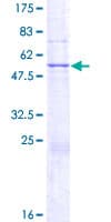Human MPHOSPH8 Protein (Recombinant GST)