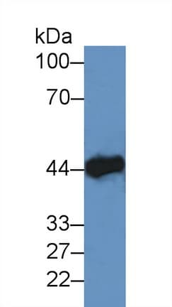 CKM / Creatine Kinase MM Antibody (aa11-367, APC)