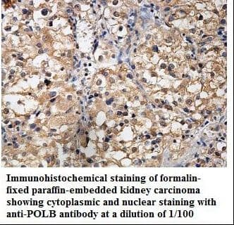 POLB / DNA Polymerase Beta Antibody (aa15-188)