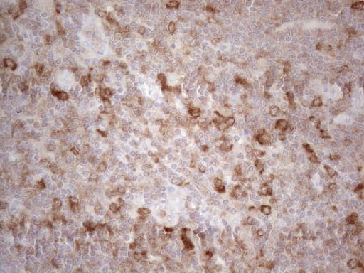 PLCXD1 Antibody (clone OTI2D7)