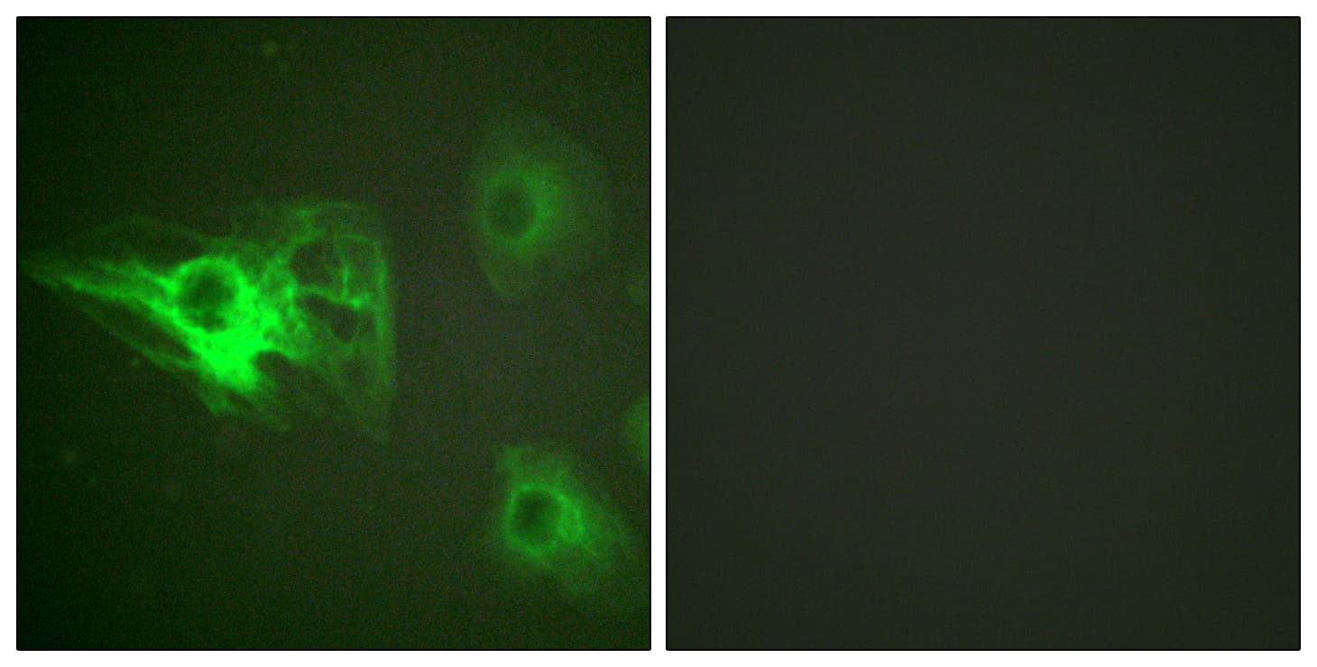 Polyclonal Rabbit anti-Human KRT8 / CK8 / Cytokeratin 8 Antibody (phospho-Ser432, IHC, IF, WB)