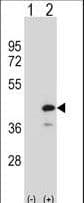 Polyclonal Rabbit anti-Human PTPN18 Antibody (aa430-459, WB)