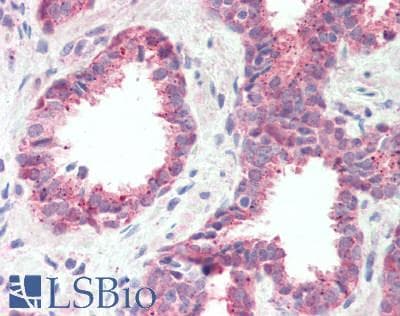 IHC-plus™ SUR2 / ABCC9 Antibody