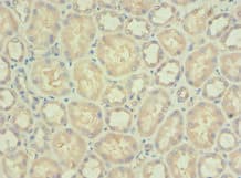 Polyclonal Rabbit anti-Human PDPK1 / PDK1 Antibody (aa277-556, IHC)