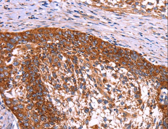 Polyclonal Rabbit anti-Human ABI1 / SSH3BP1 Antibody (IHC, WB)